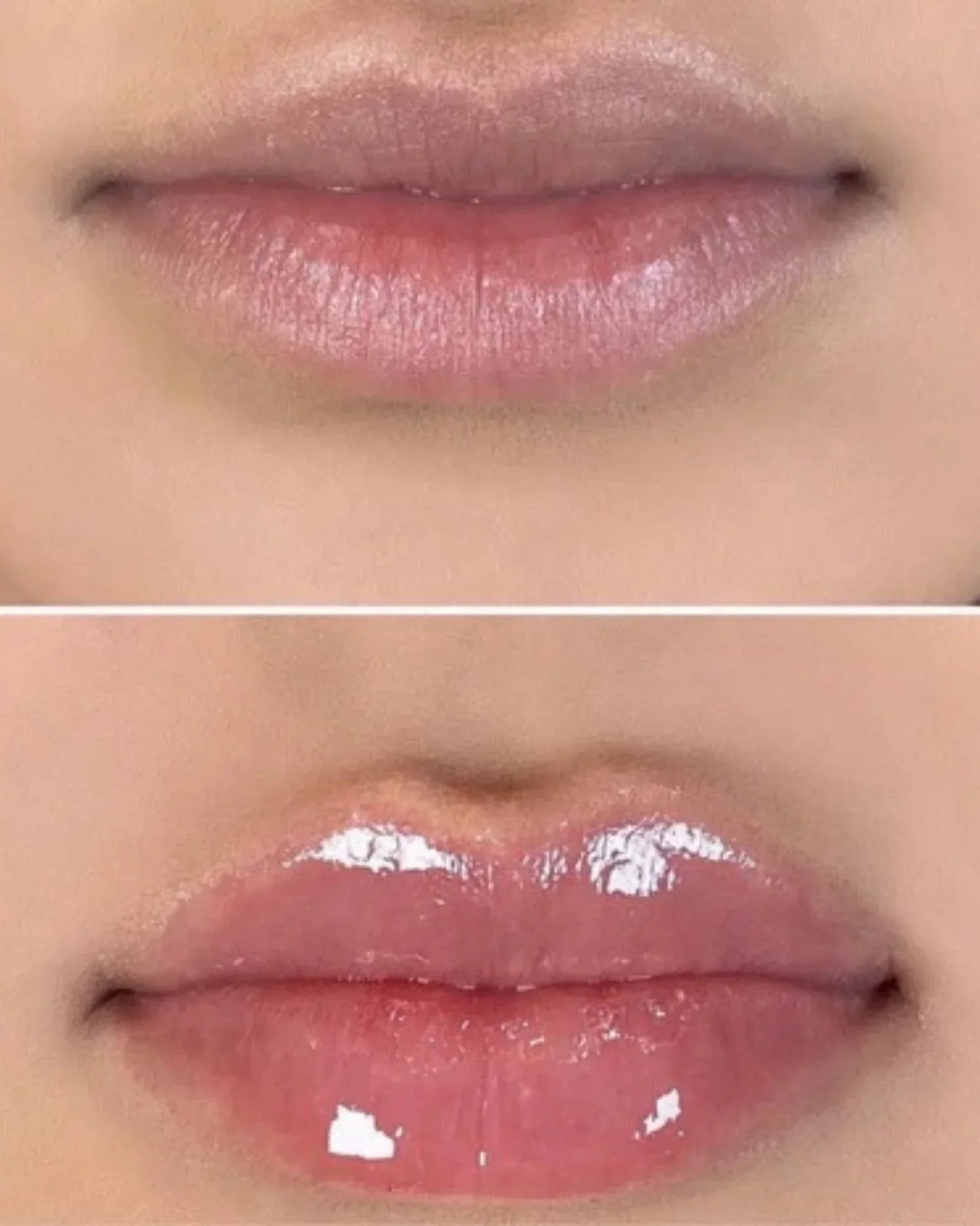 Volumizador de lábios