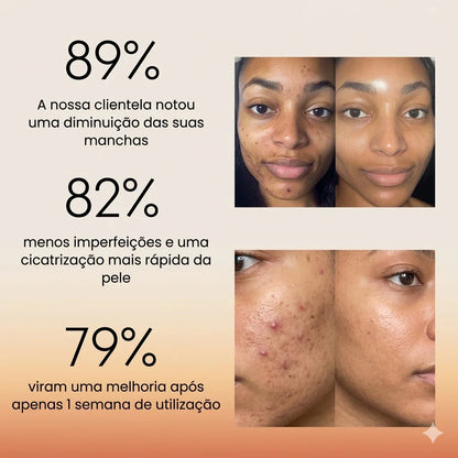 Curculia Ritual Anti-Imperfeições®